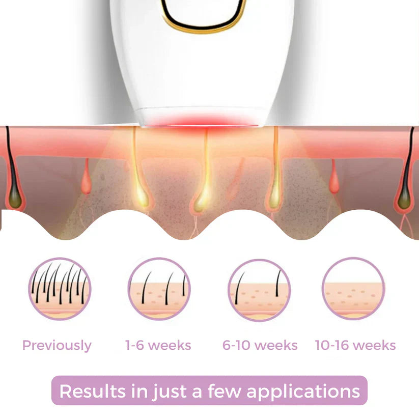 🎁 Today Promotion - 𝐁𝐞𝐚𝐮𝐭𝐲𝐏𝐥𝐮𝐬 𝐈𝐏𝐋 𝐇𝐚𝐢𝐫 𝐑𝐞𝐦𝐨𝐯𝐞𝐫 I The Leading Laser Hair Removal